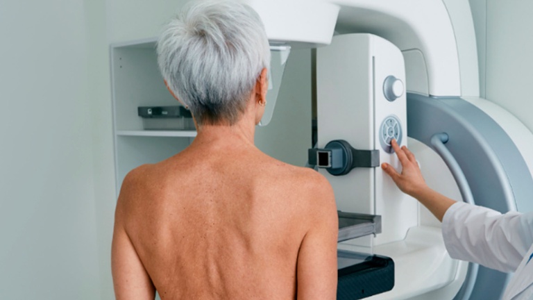 Câmara de Assis aprova criação do Dia Municipal da Mamografia, a ser celebrado em 5 de fevereiro